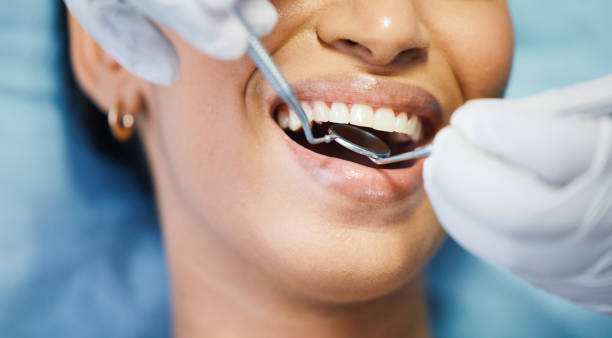 Best Emergency Tooth Extraction in Lead, SD