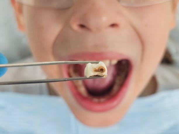 Best Emergency Dental Care for Trauma or Injury in Lead, SD